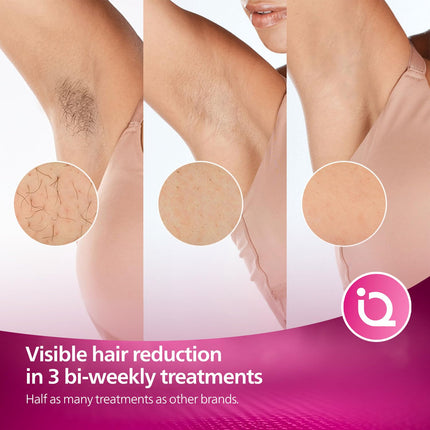 جهاز فيليبس لوميا IPL لإزالة الشعر | سلسلة 7000 | مستشعر لون البشرة | ملحقان | للجسم والوجه | قلم تشذيب صغير الحجم | يعمل بالكهرباء | BRI921/60